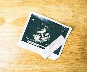 سونوگرافی دوران بارداری (غربالگری مرحله اول ،NT)