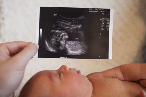 سونوگرافی دوران بارداری (رشد جنین)