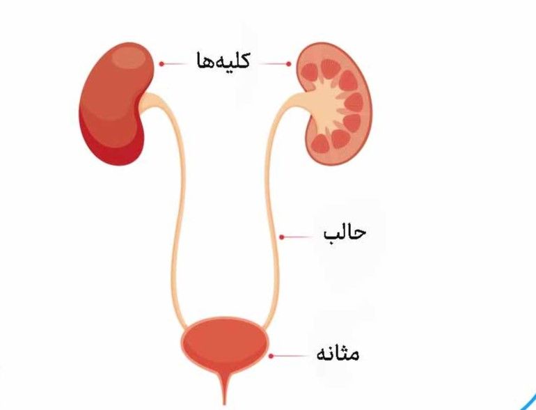 جراحی تنگی حالب