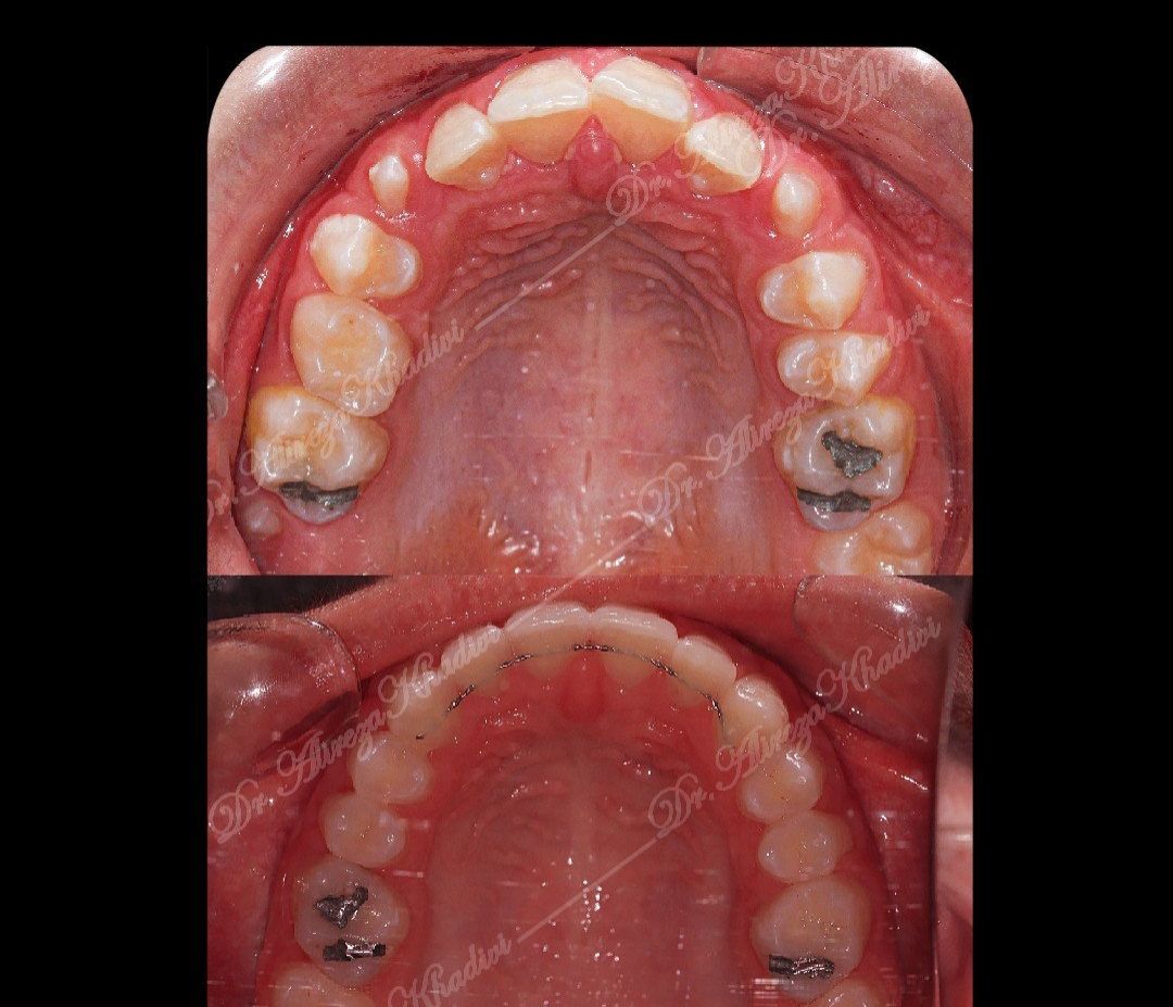 مشاوره ارتودنسی ثابت دکتر علیرضا خدیوی در تهران 5