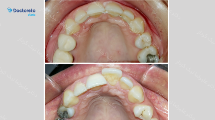 ارتودنسی ثابت (دو فک) دکتر علیرضا نیک کردار در تهران 39