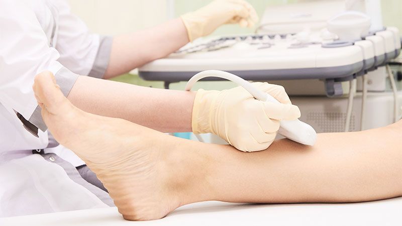 سونوگرافی داپلر عروق پا