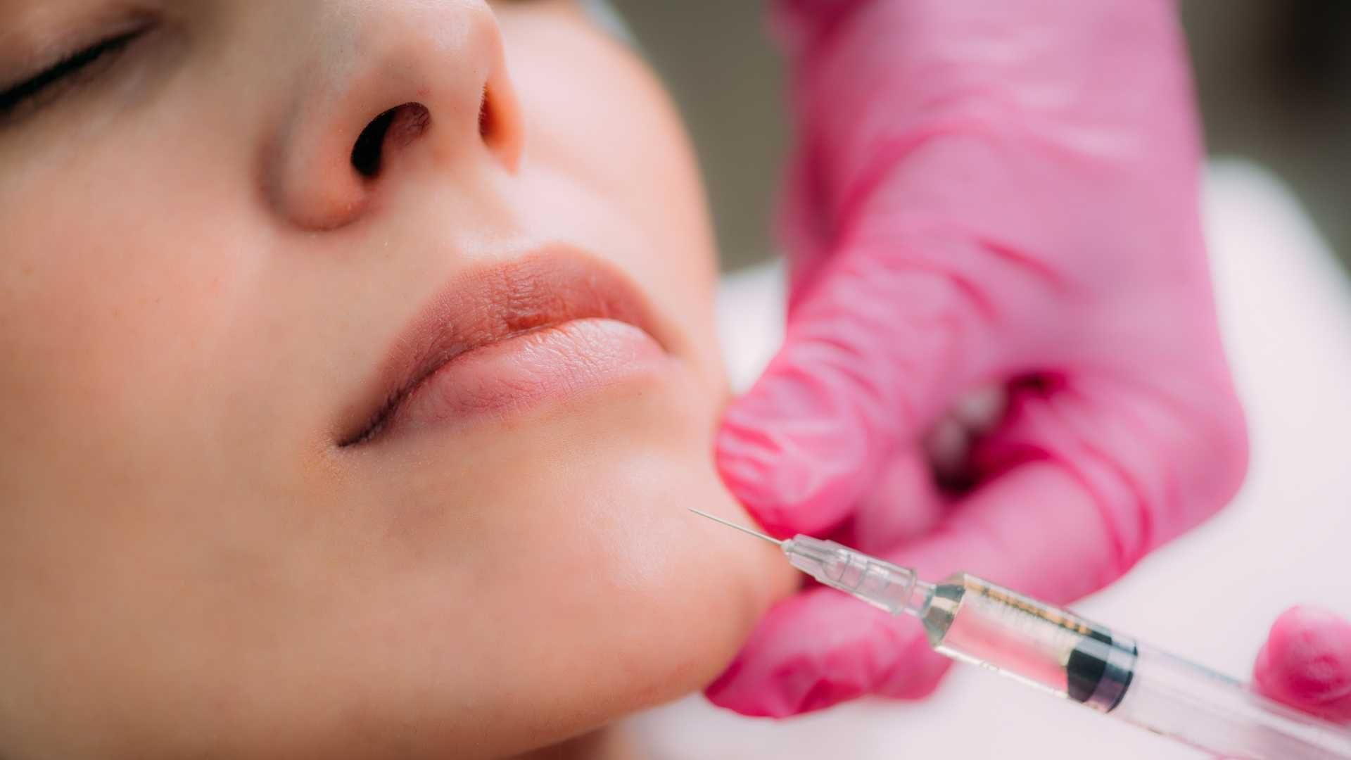 تزریق چربی به ناحیه صورت (کل صورت)