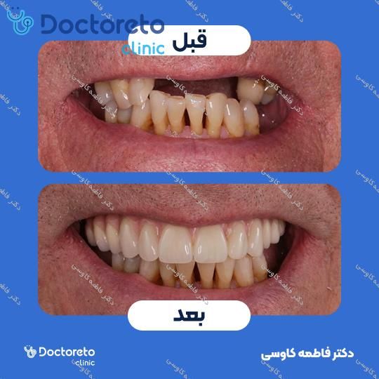 جراحی بازسازی استخوان