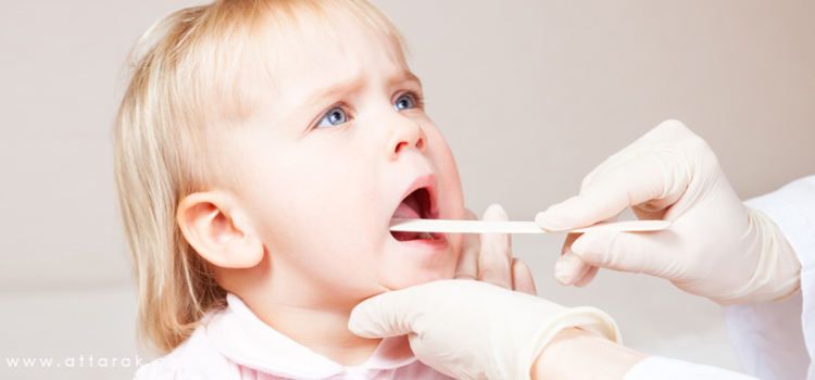 عمل جراحی لوزه (اطفال)