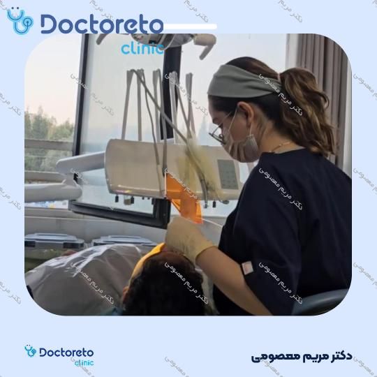 جرم گیری دندان با بروساژ 🦷