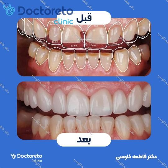 جراحی پیوند استخوان (هر واحد)
