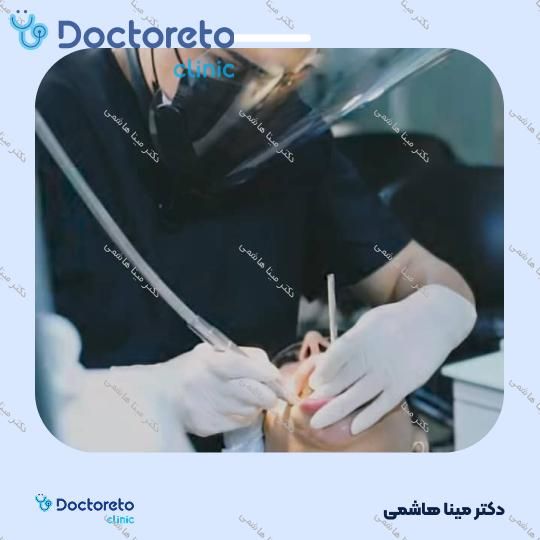 جرم گیری دندان با بروساژ 🦷