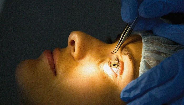 عمل لازک پیشرفته