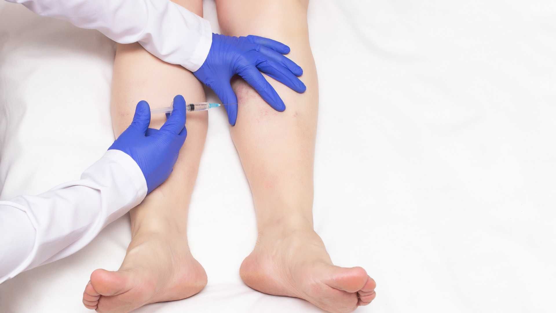 تزریق چربی و نانو فت به ناحیه لابیا