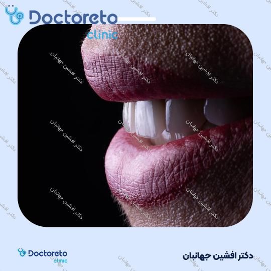 روکش دندان (هر واحد)