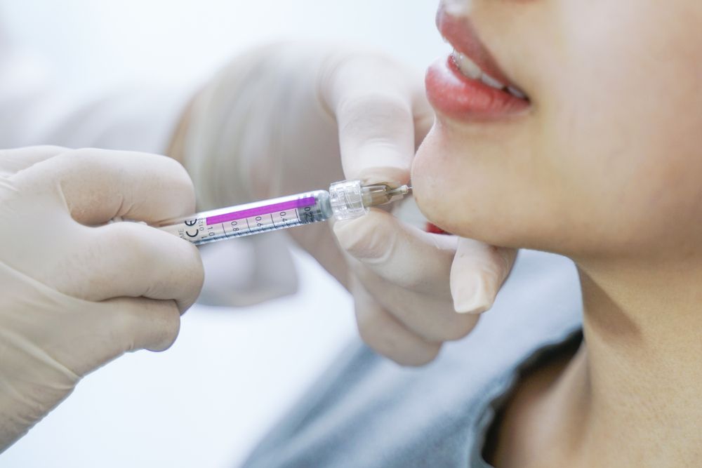 تزریق ژل چانه