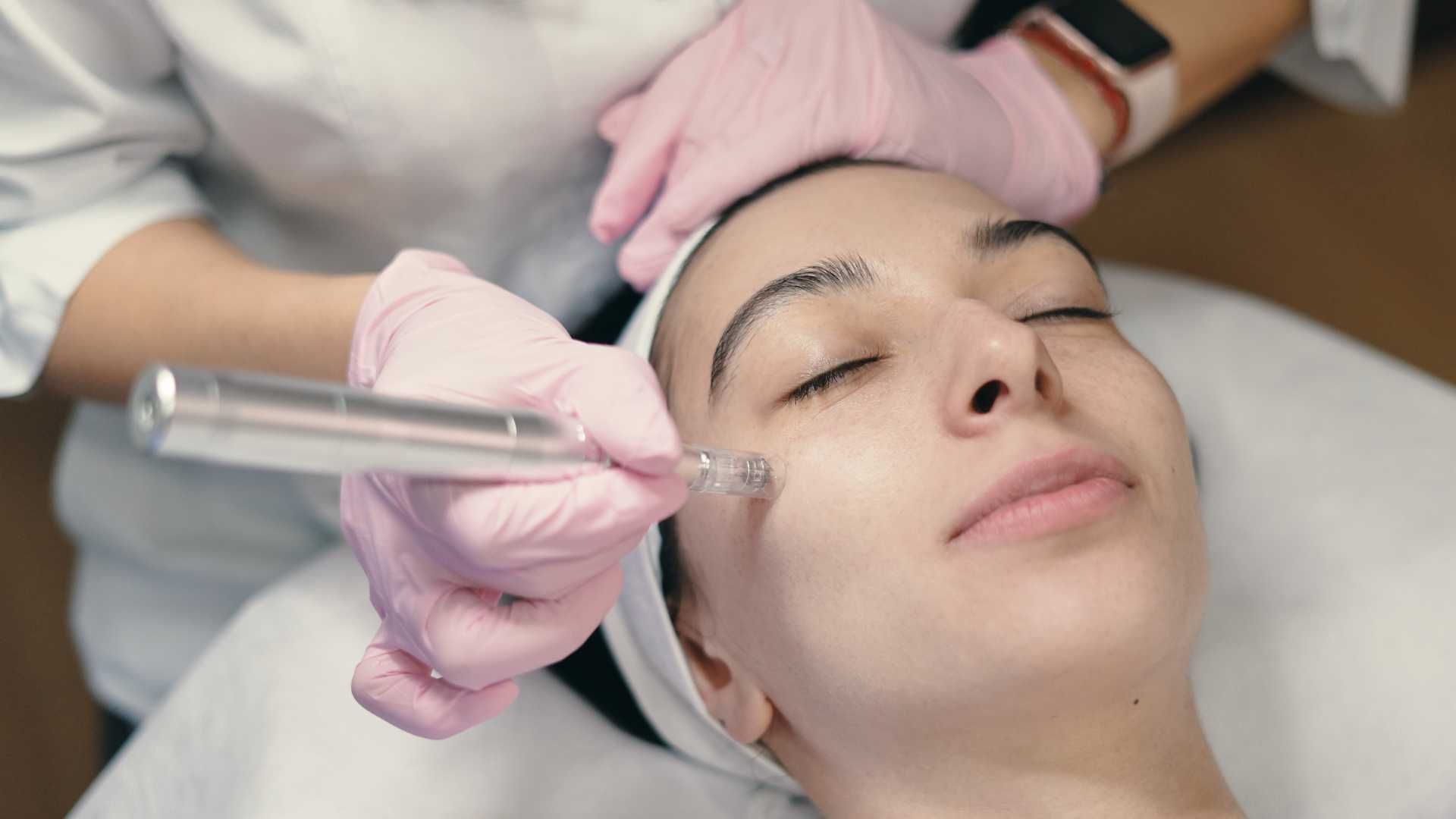 جوانسازی کل صورت با لیزر RF فرکشنال