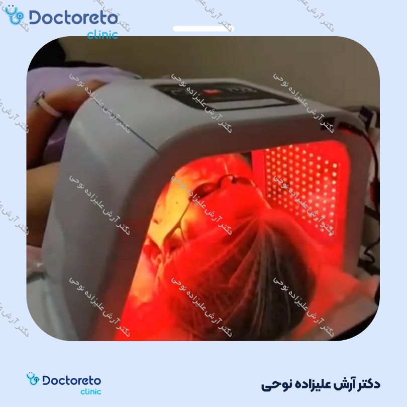 تزریق مزوتراپی مو جهت قطع ریزش مو