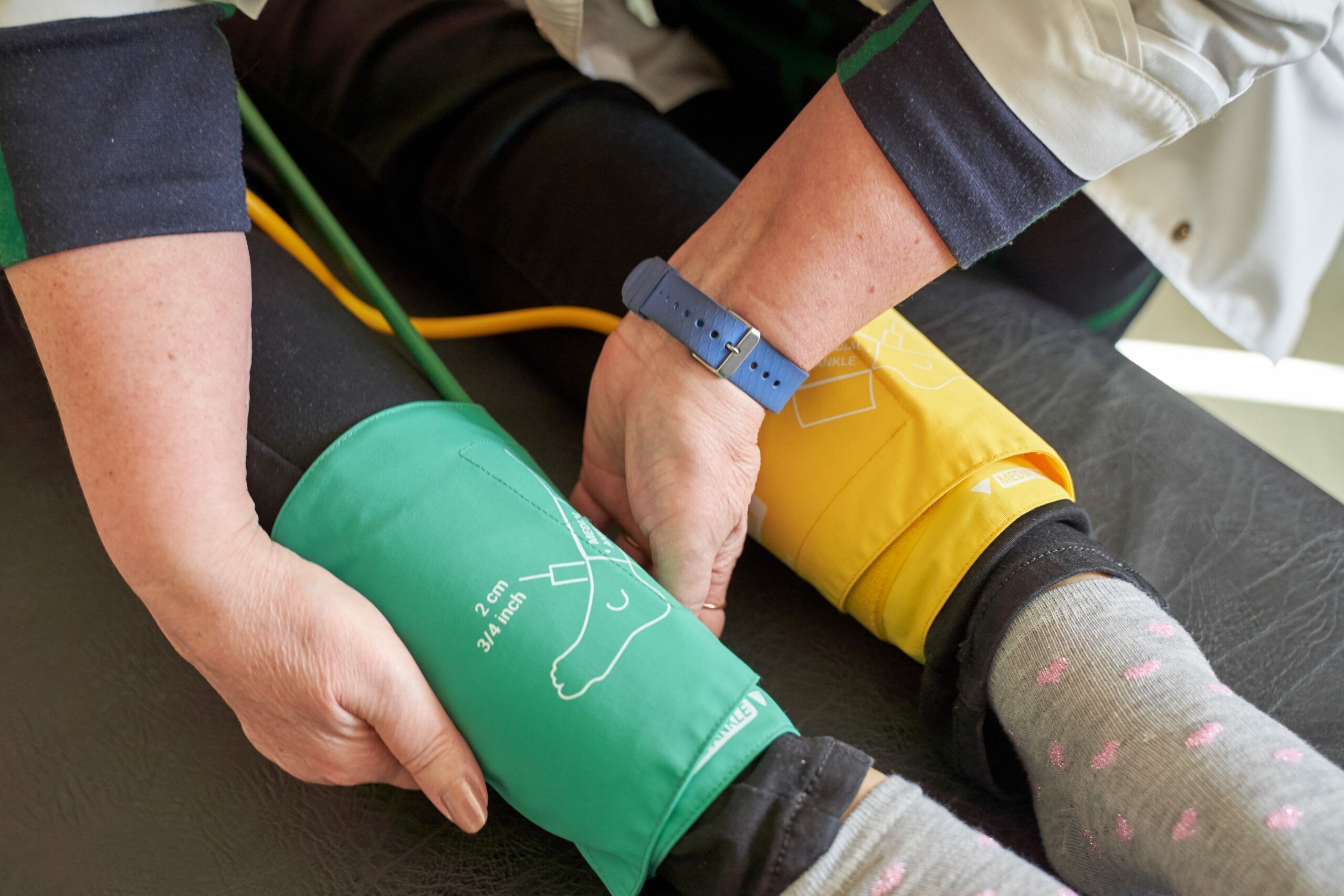 بررسی گرفتگی عروق با دستگاه ABI