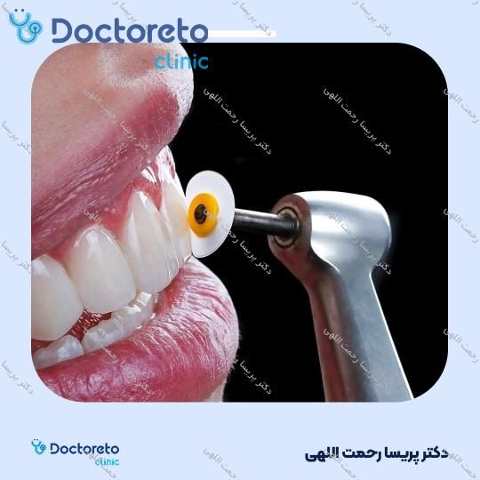 جرم گیری دندان با بروساژ🦷