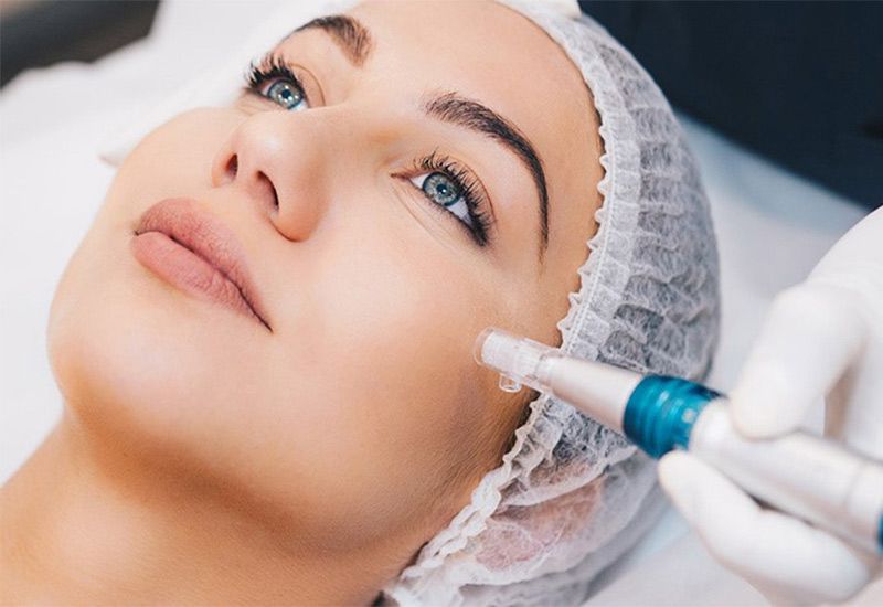 تزریق ژل زیر چشم