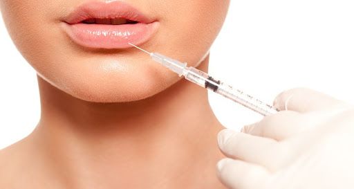 تزریق ژل لب