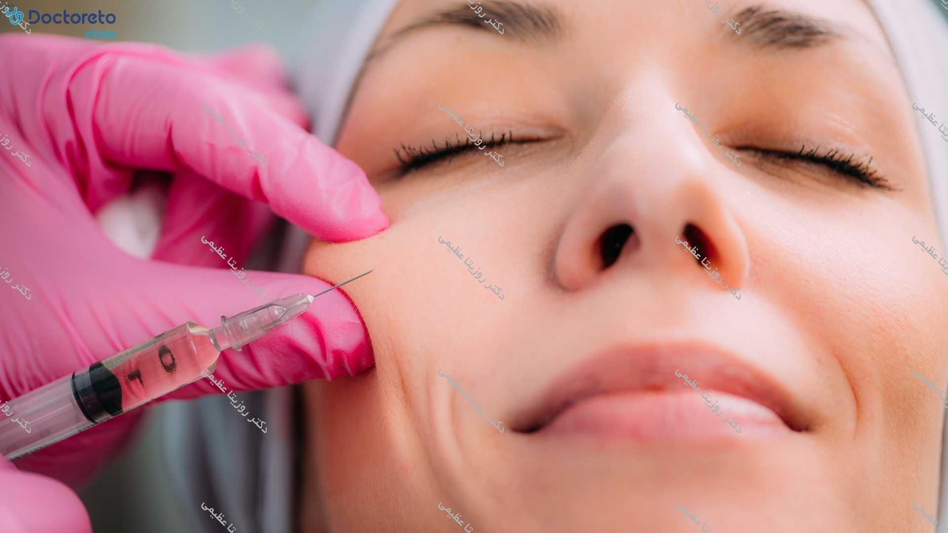 تزریق ژل گونه با برند لوناژل (1CC)