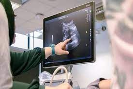 سونوگرافی واژینال