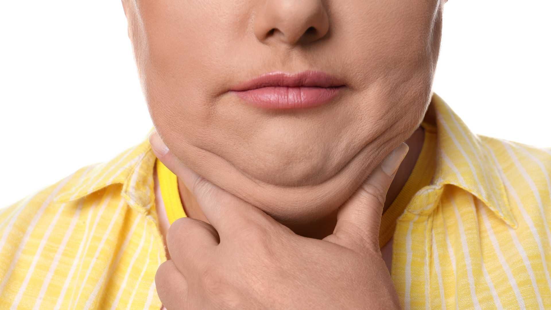 تزریق مزوتراپی جهت رفع غبغب و لاغری