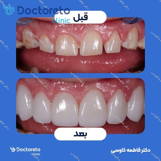 جراحی پیوند استخوان (هر واحد)