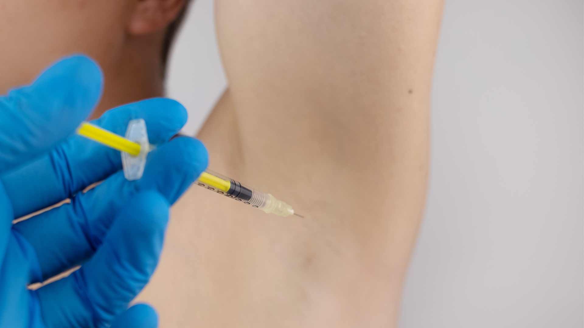 تزریق بوتاکس ضد تعریق (هایپر هیدروسیس)