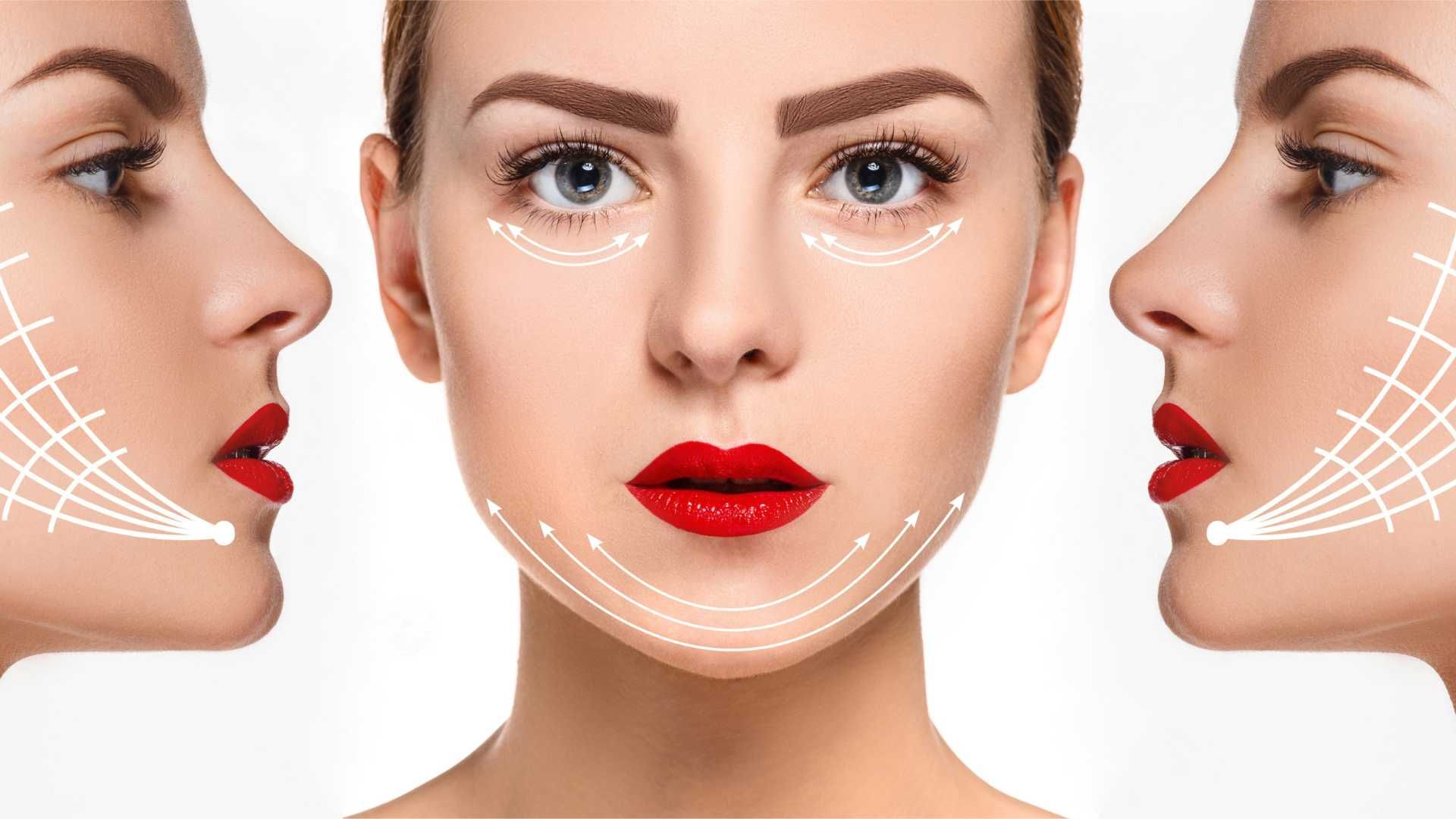 لیفت صورت با نخ