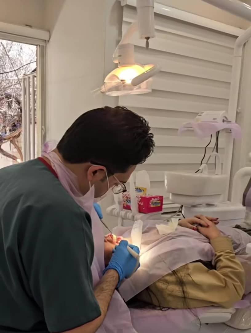 جرم گیری دندان با بروساژ 🦷