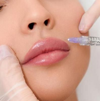 تزریق ژل لب