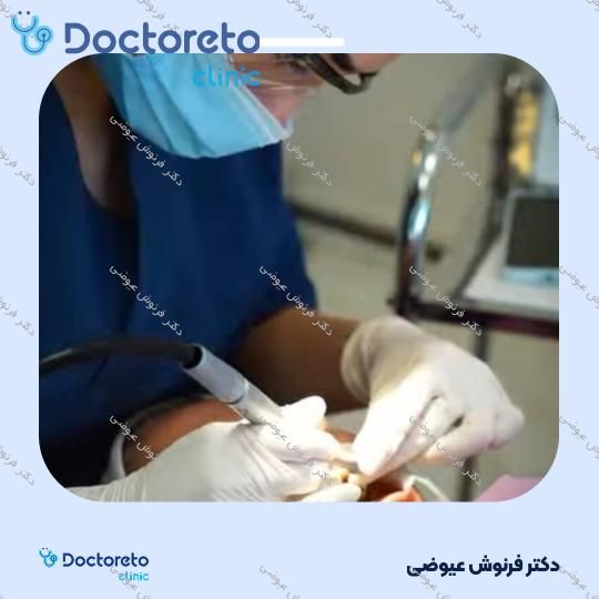 جرم گیری کامل دندان‌های دو فک با بروساژ🦷