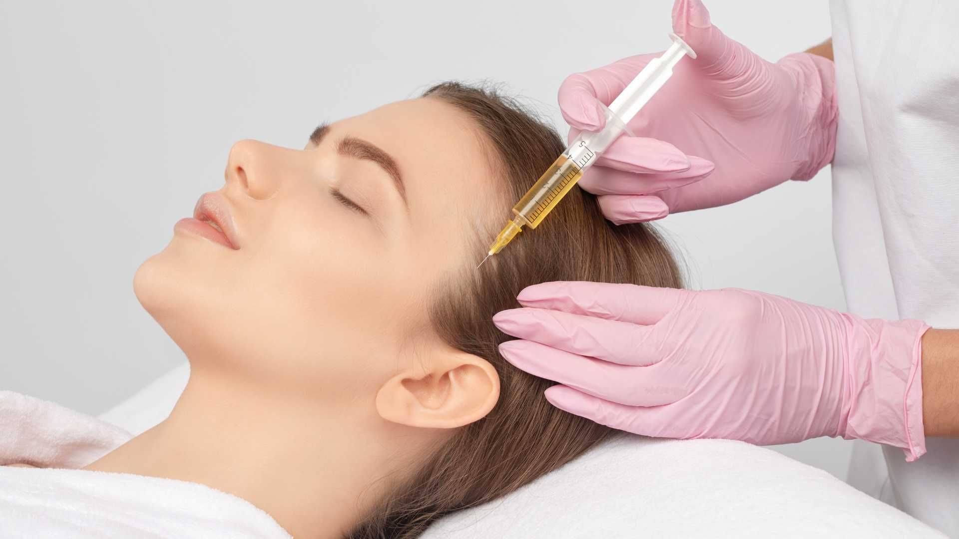 تزریق مزوتراپی موی سر جهت قطع ریزش مو