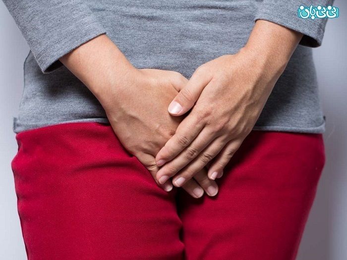 لابیاپلاستی (زیبایی واژن) با لیزر RF