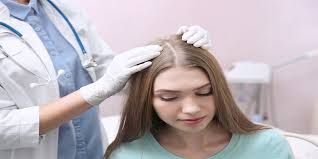 آزمایش ریزش مو در زنان