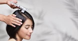 آزمایش ریزش مو در زنان