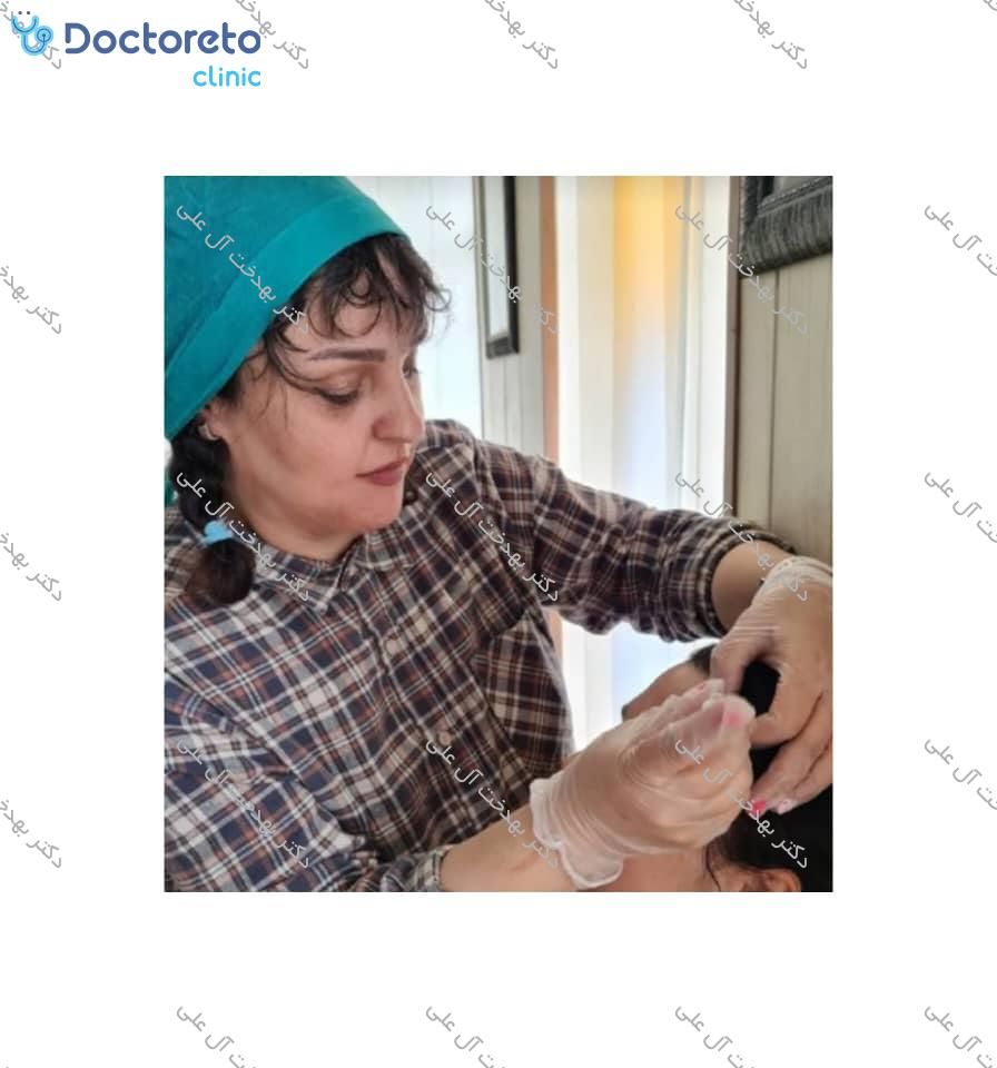 تزریق بوتاکس صورت (پیشانی، خط اخم، پنجه کلاغی)💉