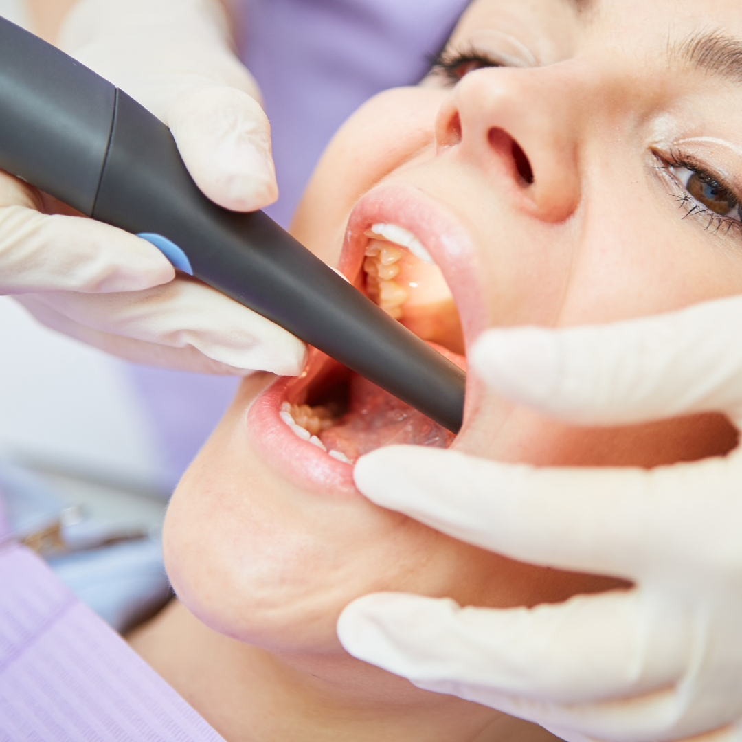 عصب کشی دندان