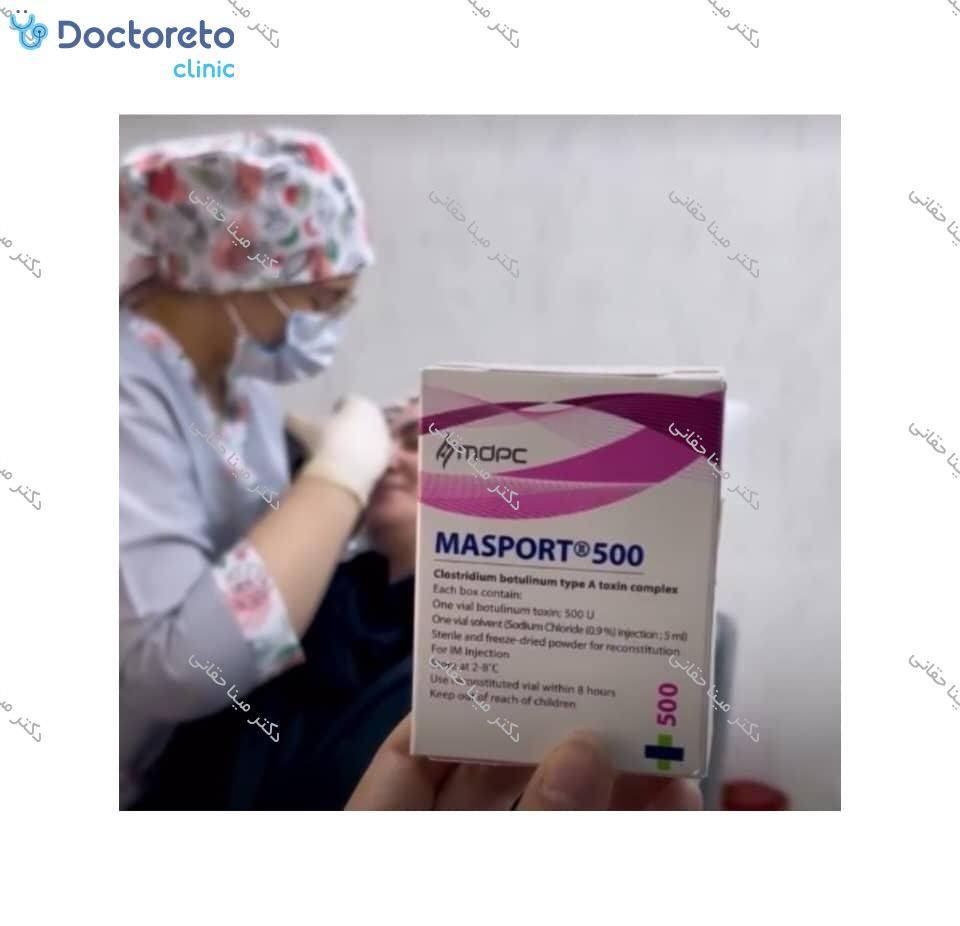 تزریق بوتاکس صورت (پیشانی، خط اخم، پنجه کلاغی)💉