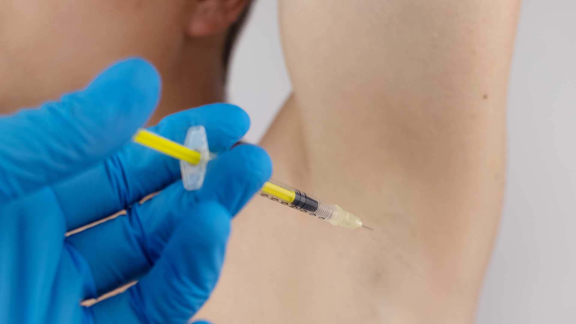 تزریق بوتاکس ضد تعریق (هایپر هیدروسیس)