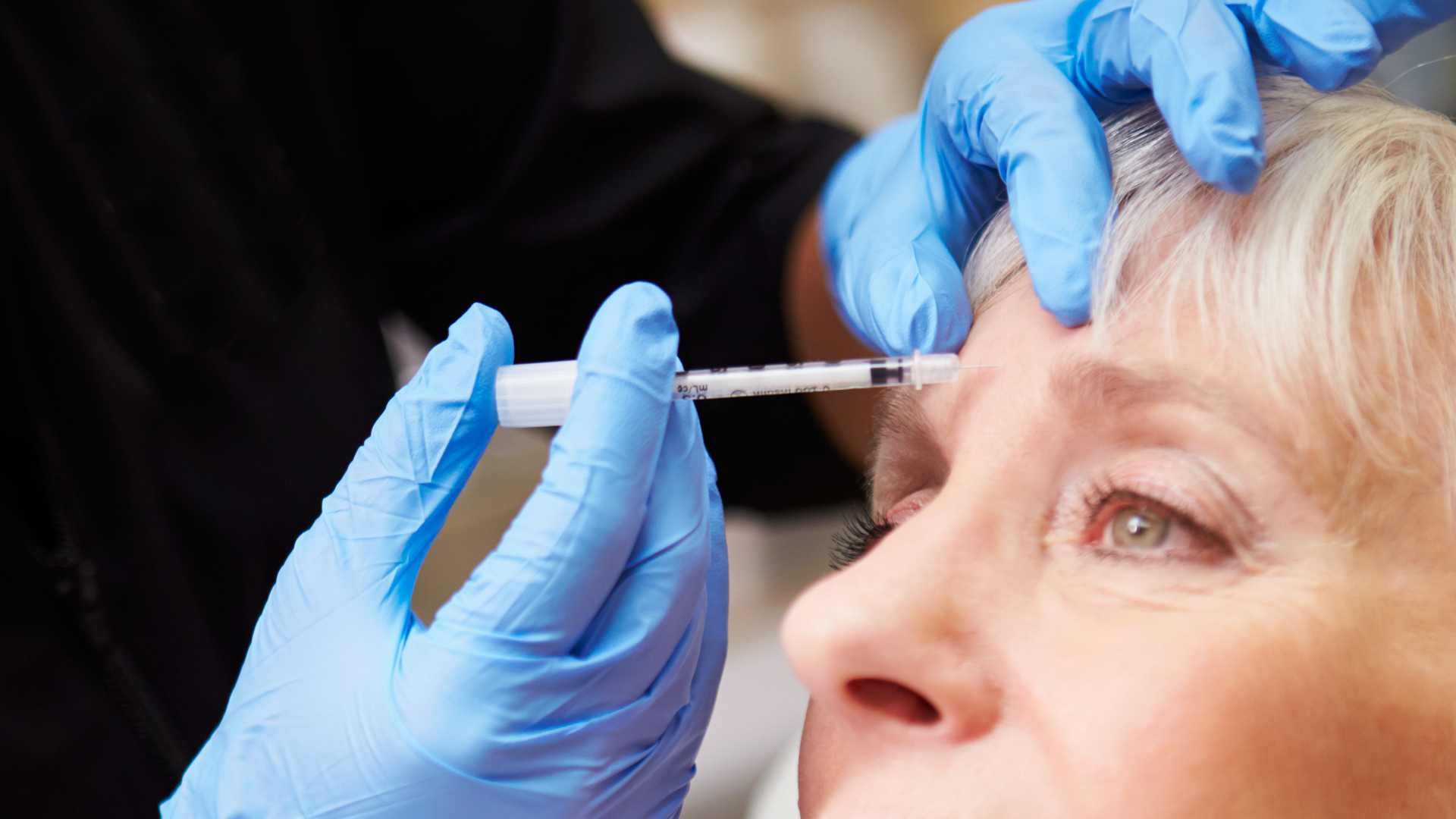 تزریق بوتاکس صورت (پیشانی، خط اخم، پنجه کلاغی)