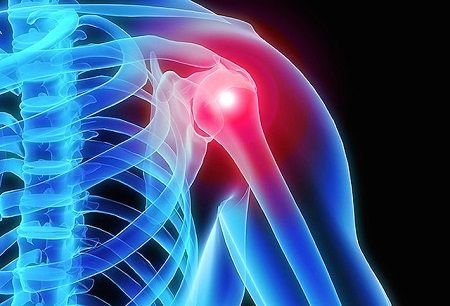 فیزیوتراپی تخصصی درد های زانو و شانه با دستگاه سی پی ام (cpm) و تمرین های درمانی