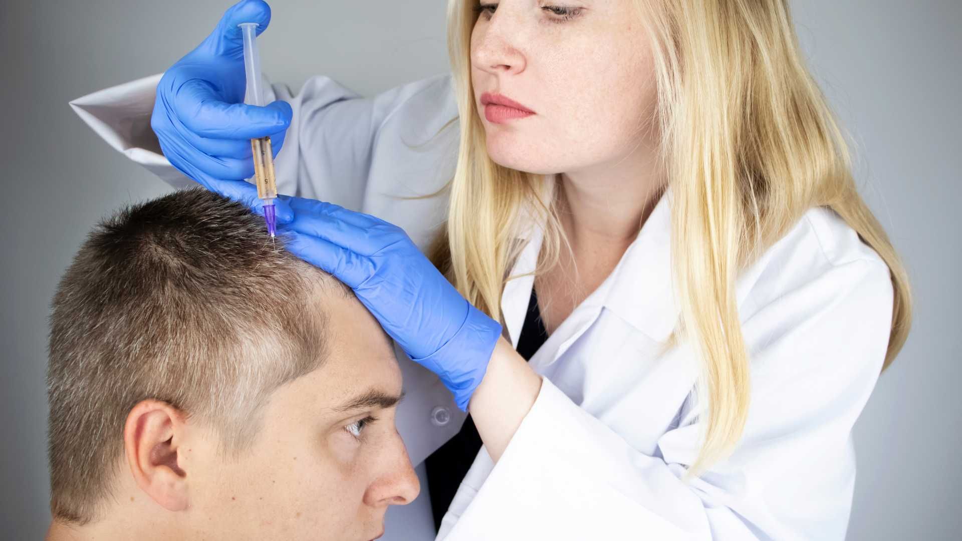 درمان ریزش موی سر با مزوتراپی