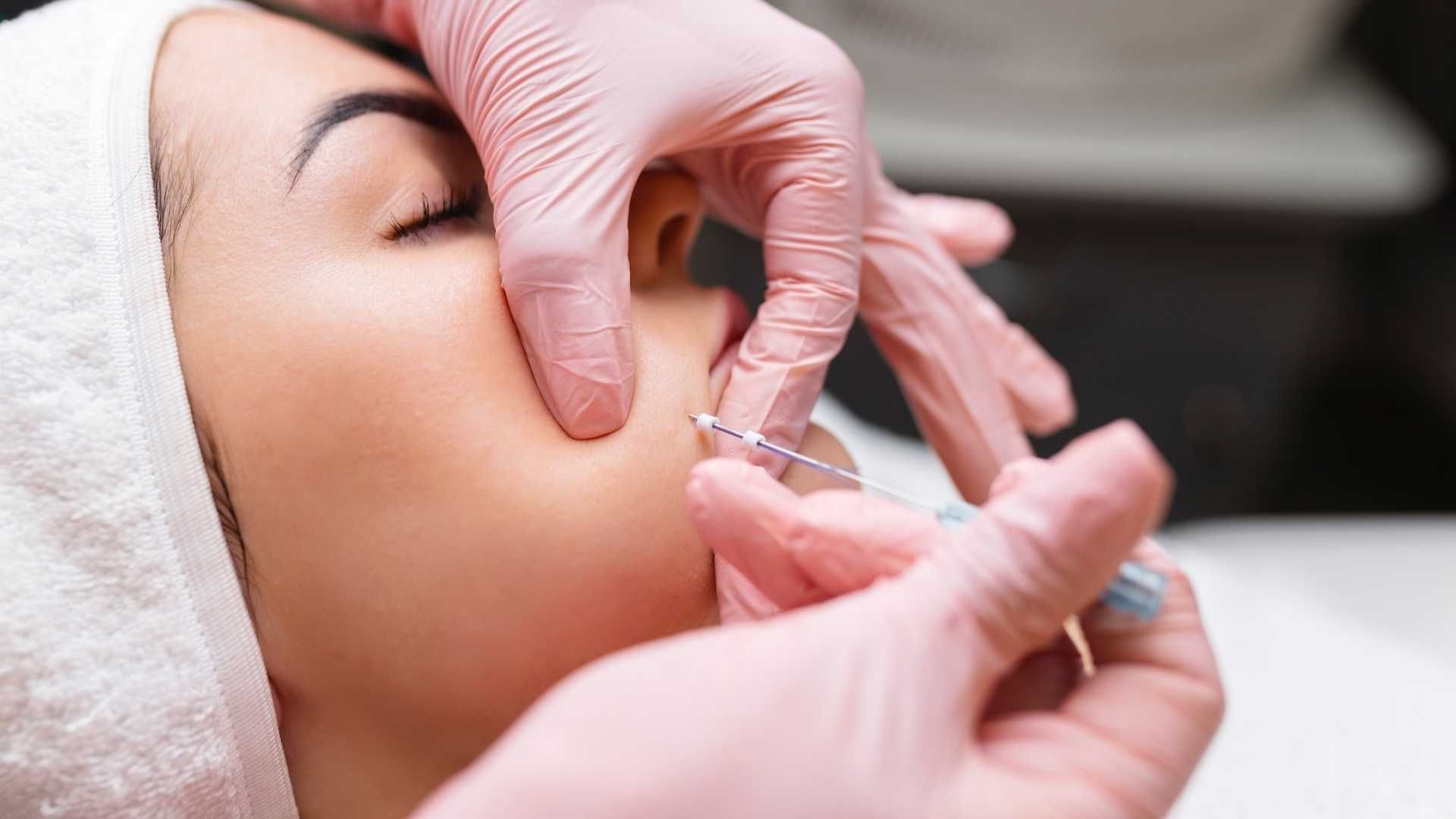 جوانسازی صورت با استفاده از نخ های کلاژن ساز