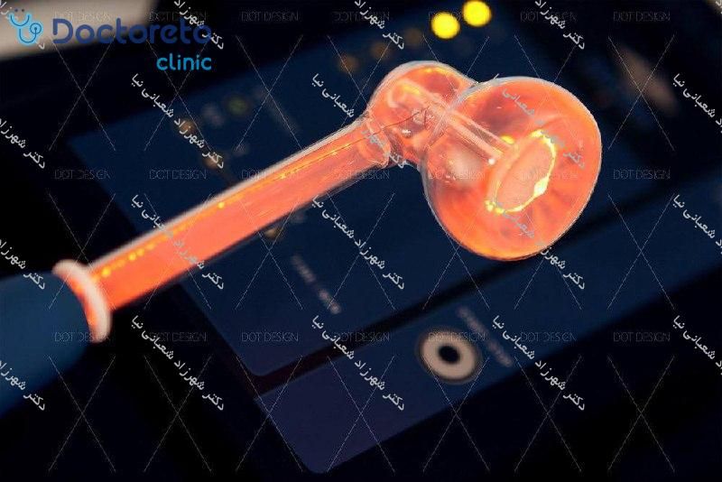 درمان عفونت واژن (هر جلسه)