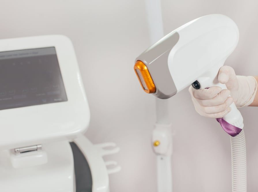 پاک کردن تتو با استفاده از دستگاه لیزر کیو سوئیچ (هر جلسه)