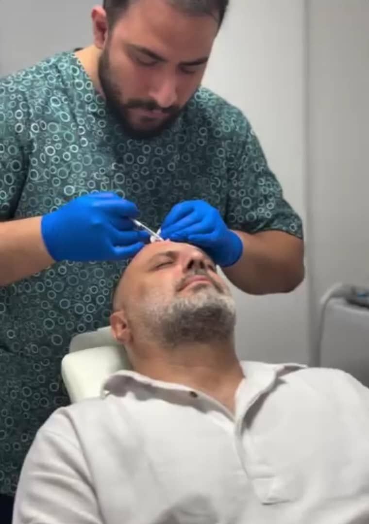 تزریق بوتاکس صورت (پیشانی، خط اخم، پنجه کلاغی)