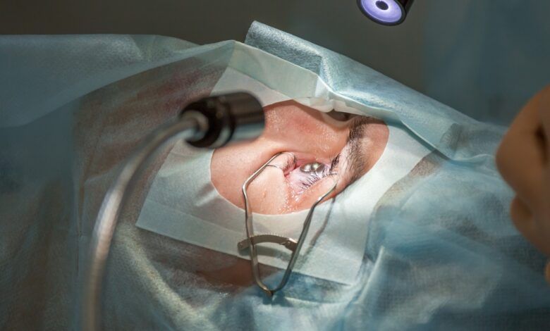 عمل فیکو چشم با لنز آمریکایی