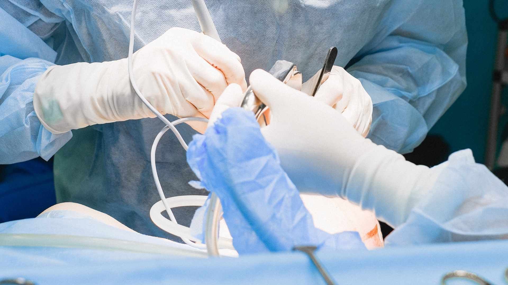 سینوس لیفت باز