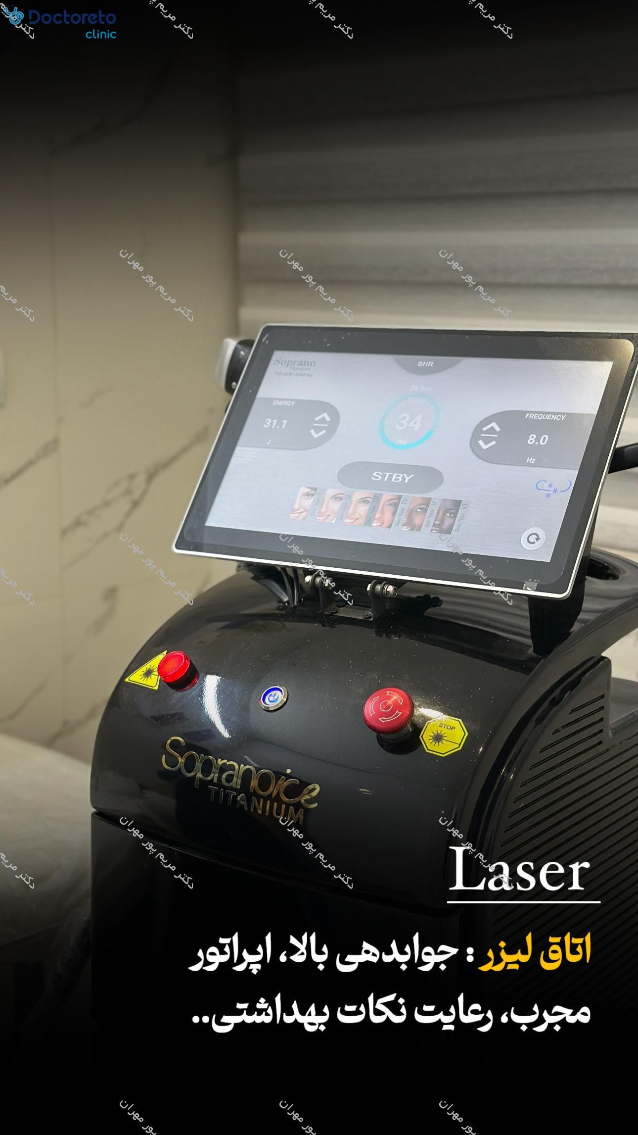 لیزر موهای زائد بانوان با دستگاه سوپرانو آیس تیتانیوم ⚡
