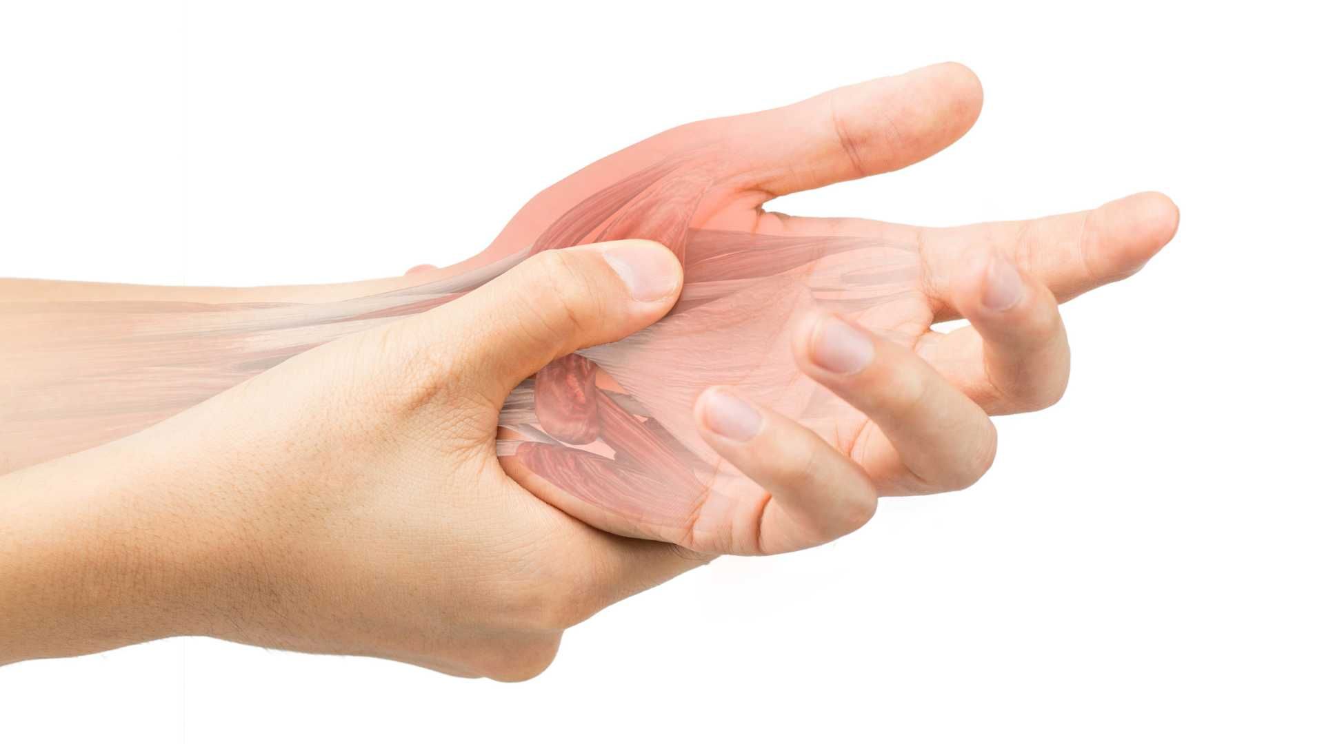 جراحی آزادسازی عصب دست (تونل کارپال CTS)